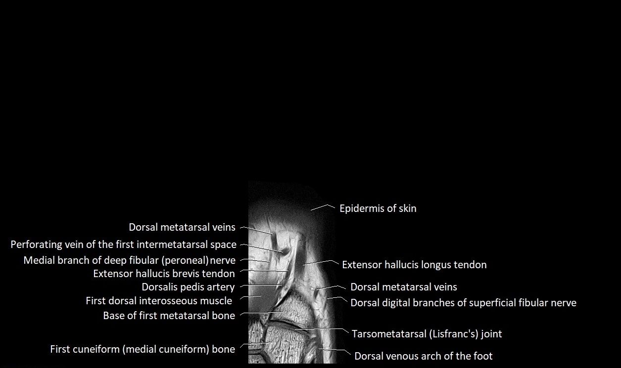 Great Toe micro anatomy MRI axial cross sectional 3T image 6.webp